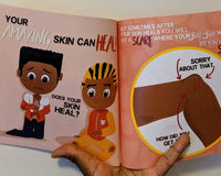 My Amazing Skin Can Heal: A Book About Boo-Boos, Bandages and Band Aids (Human Body For Kids)